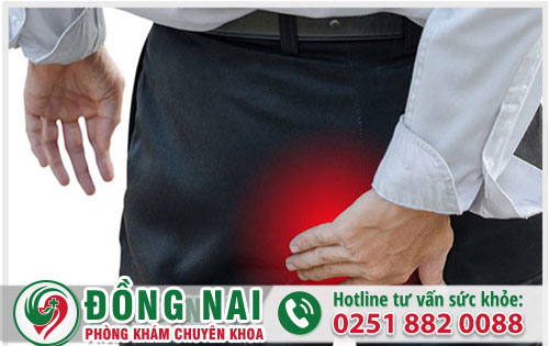 Thế nào là trĩ huyết khối và cách hỗ trợ khắc phục hiệu quả