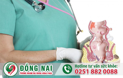Thuốc điều trị bệnh trĩ hiệu quả hiện nay