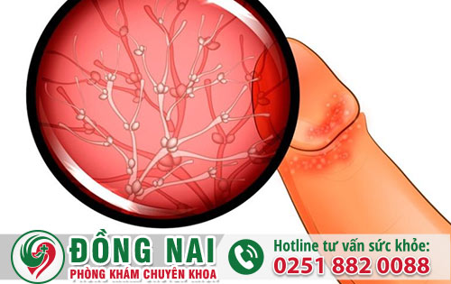 Tình trạng xuất hiện vật thể lạ hậu môn cảnh báo bệnh gì?