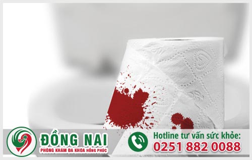 Triệu chứng bệnh ỉa ra máu