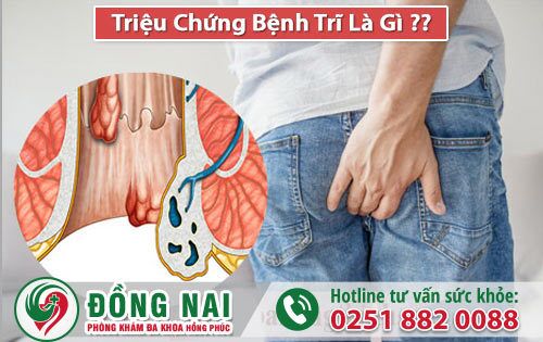 Triệu chứng bệnh trĩ là gì? Nguyên nhân và cách chữa trị hiệu quả