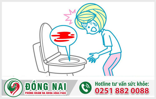Xuất huyết hậu môn là gì? Nguyên nhân và phương pháp điều trị